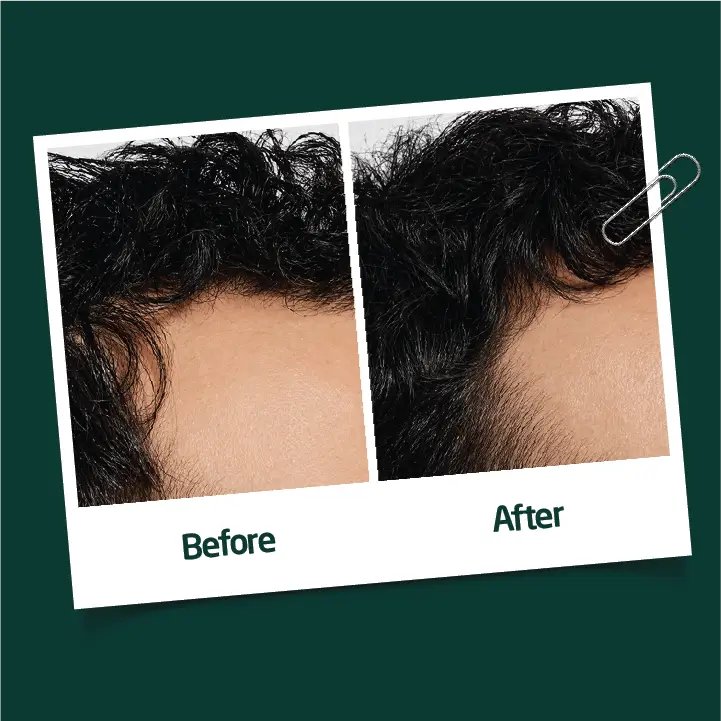 Reroot™ Spray Ohamza