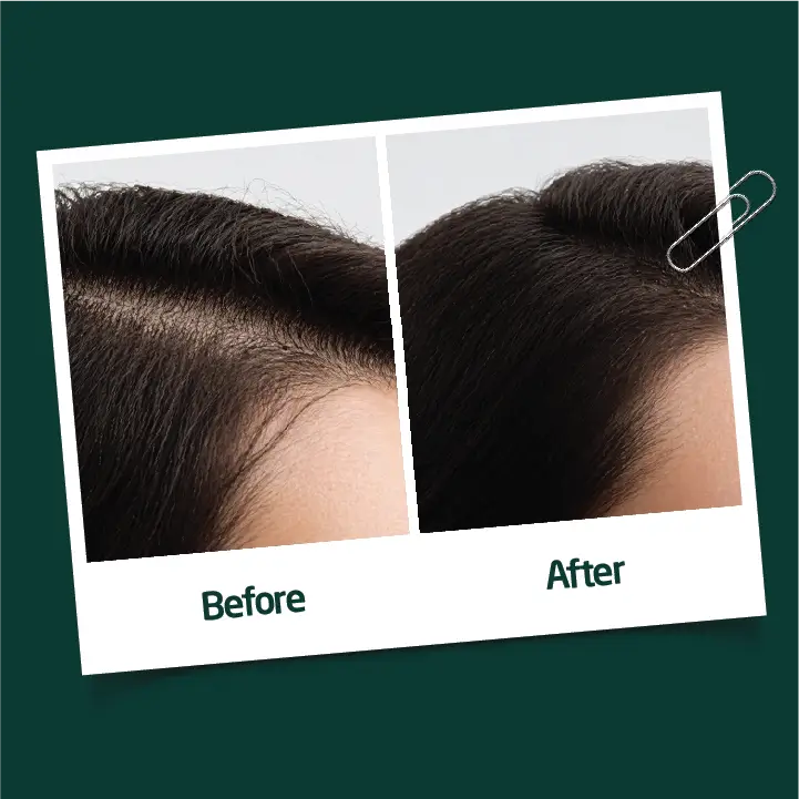 Reroot™ Spray Ohamza